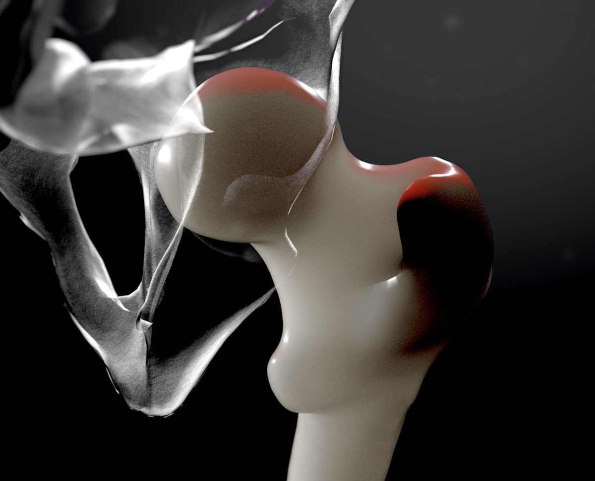bio_comp's tweet photo. The next CompBioMed and @VPH_Institute e-Seminar approaches! 23 November 2022 at 2pm CET, Dr La Mattina from @Unibo will talk about "Predicting and preventing bone fractures with HPC". Info and registration 👉 https://t.co/HxolB0xinv https://t.co/oOfFozmNrc