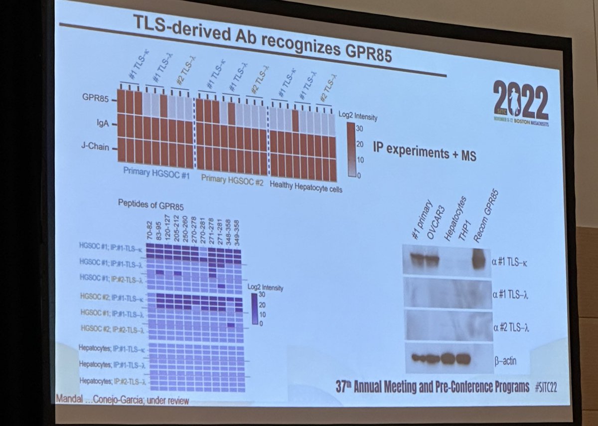 BernardAFox's tweet photo. 4) Profs. @sautesfridm & Hadyn Kissick chair a Fantastic session on tertiary #lymphoid #Structures #TLS /Dr José Conejo-Garcia 💥AB FROM TLS B CELLS ABROGATE TUMOR GROWTH 💥 #SITC2022 #SITC22 B Cell Zone/ #Mab #FinishCancer #IL21 #CXCL13 #OvarianCancer https://t.co/EYMQcQtJkD