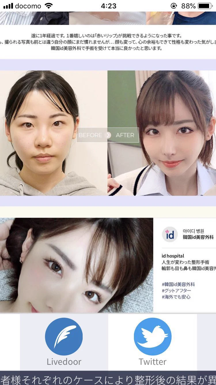 深田 えい み 整形