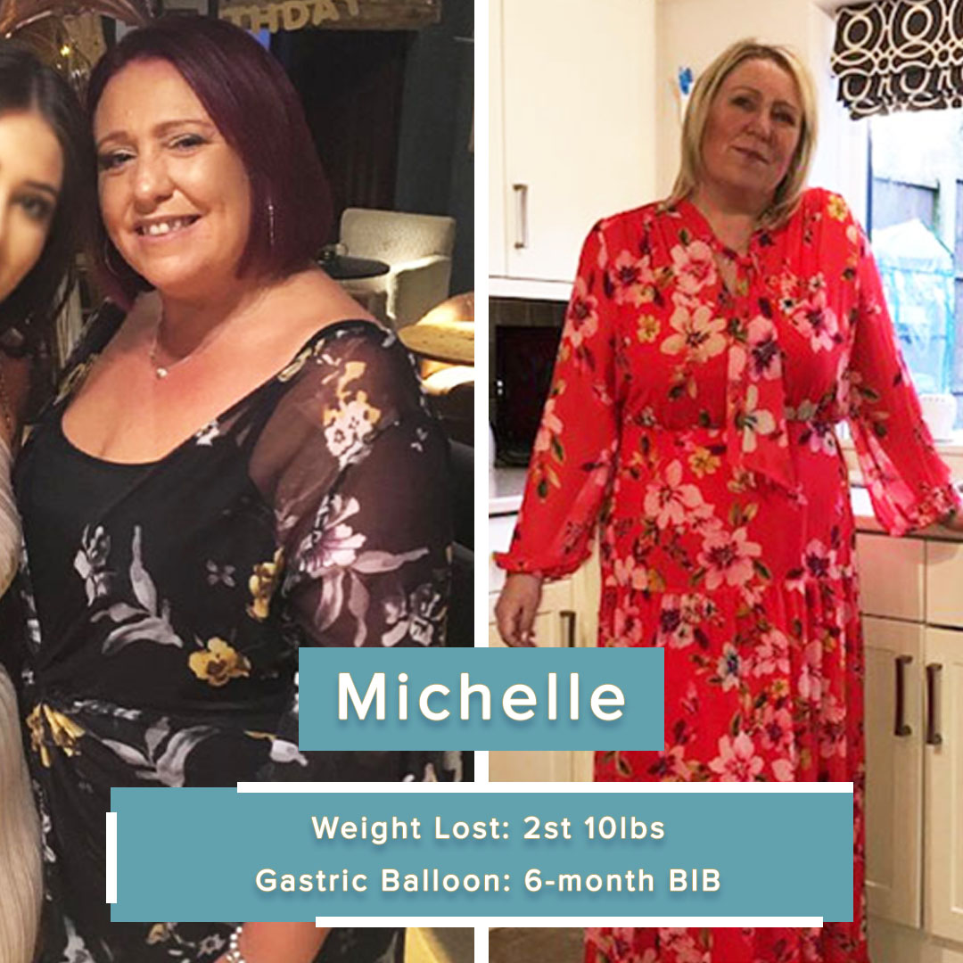 With the help of our gastric balloon, Michelle lost 2st 10lbs! Ready to live life to the max! 💪🥳🎉 Michelle's weight loss journey: gastricballoongroup.com/gastric-balloo… #gastricballoon #testimonial #tbt #throwback #transformation #uk #weightlossjourney #beforeandafter #testimonials #bham