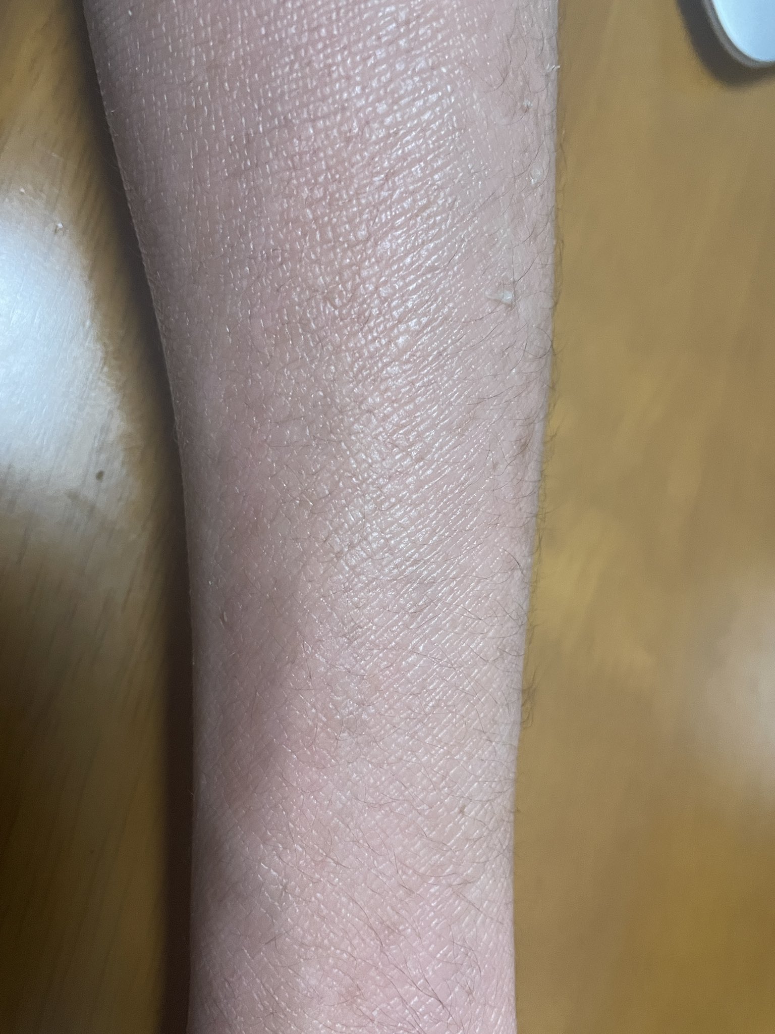 魚鱗癬 Twitter Search Twitter