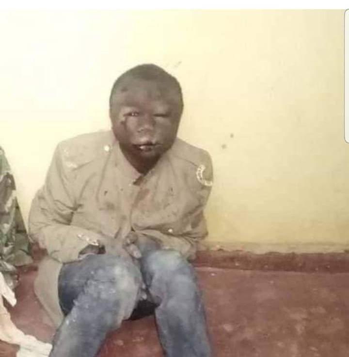 Thabokadi7's tweet photo. @RatoSM_ @bokoromonio Imagine if it was you forehead forensics would be on your case https://t.co/yLlpApOzpp