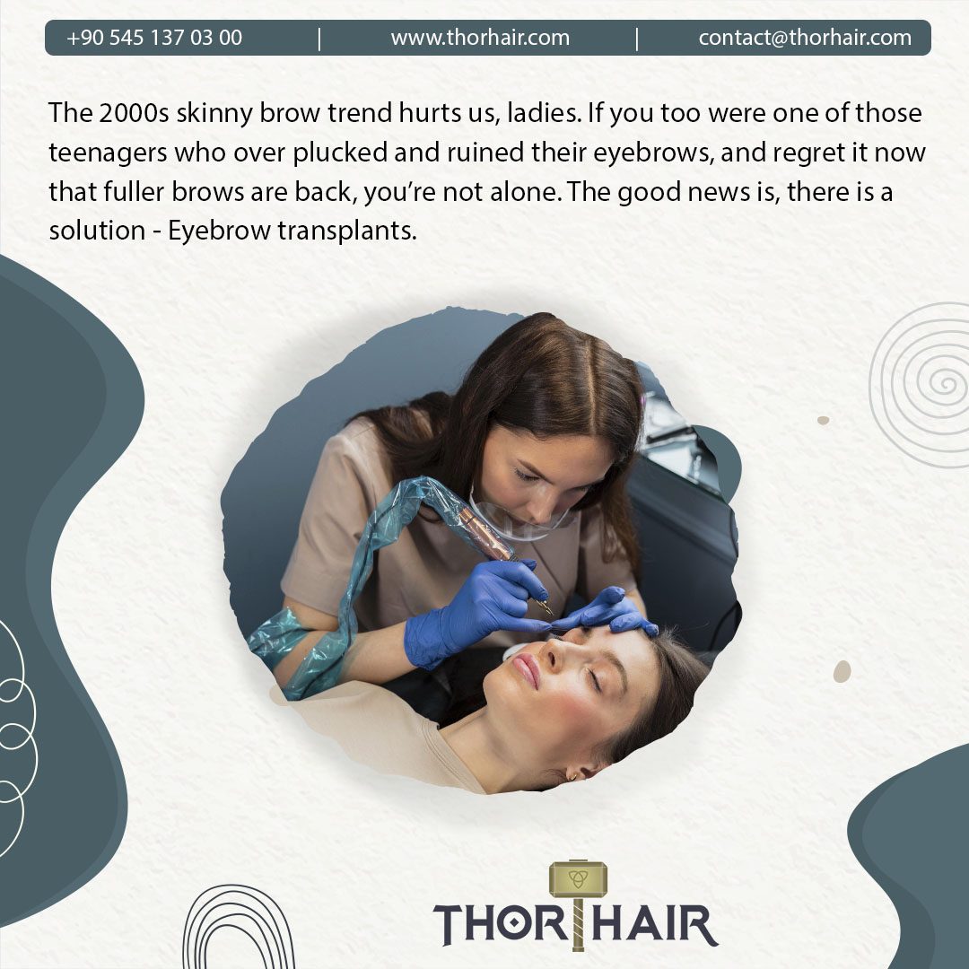 ThorHair's tweet photo. The 2000s skinny brow trend hurts us, ladies. 

If you too were one of those teenagers who over plucked and ruined their eyebrows, and regret it now that fuller brows are back, you’re not alone.

https://t.co/4pn3M0RuAK

#ThorHairClinic #HairTransplant #EyebrowTransplant https://t.co/0oC0tqUSLv