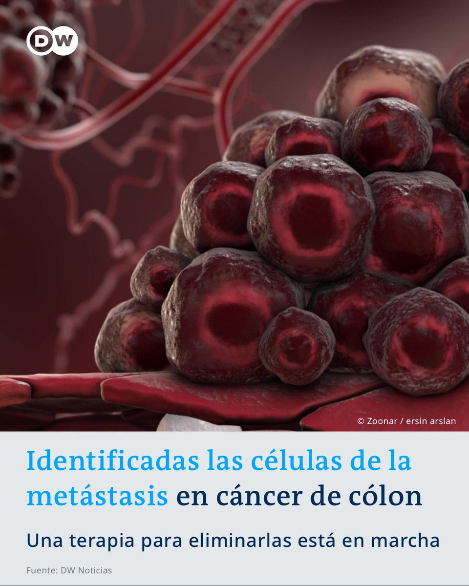 dw_espanol's tweet photo. Científicos españoles descubren las células malignas que provocan metástasis

El estudio se centró en el #cancer de colon. Los investigadores del Instituto de Investigación Biomédica de Barcelona sugieren una nueva terapia para eliminarlas. 

#DWNoticias /es https://t.co/BEpkeurKAU