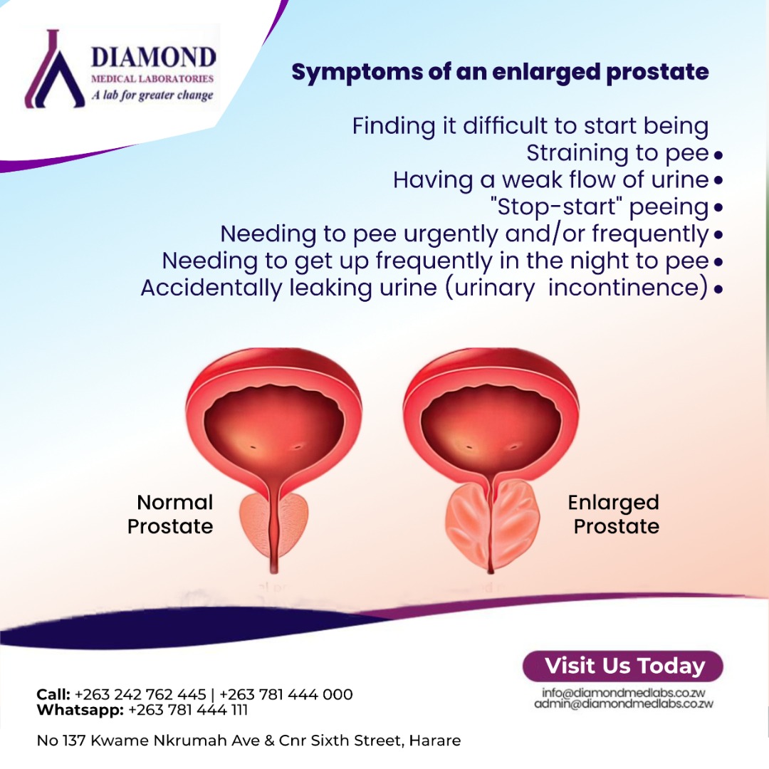 Diamond Medical Laboratories ZW tweet media