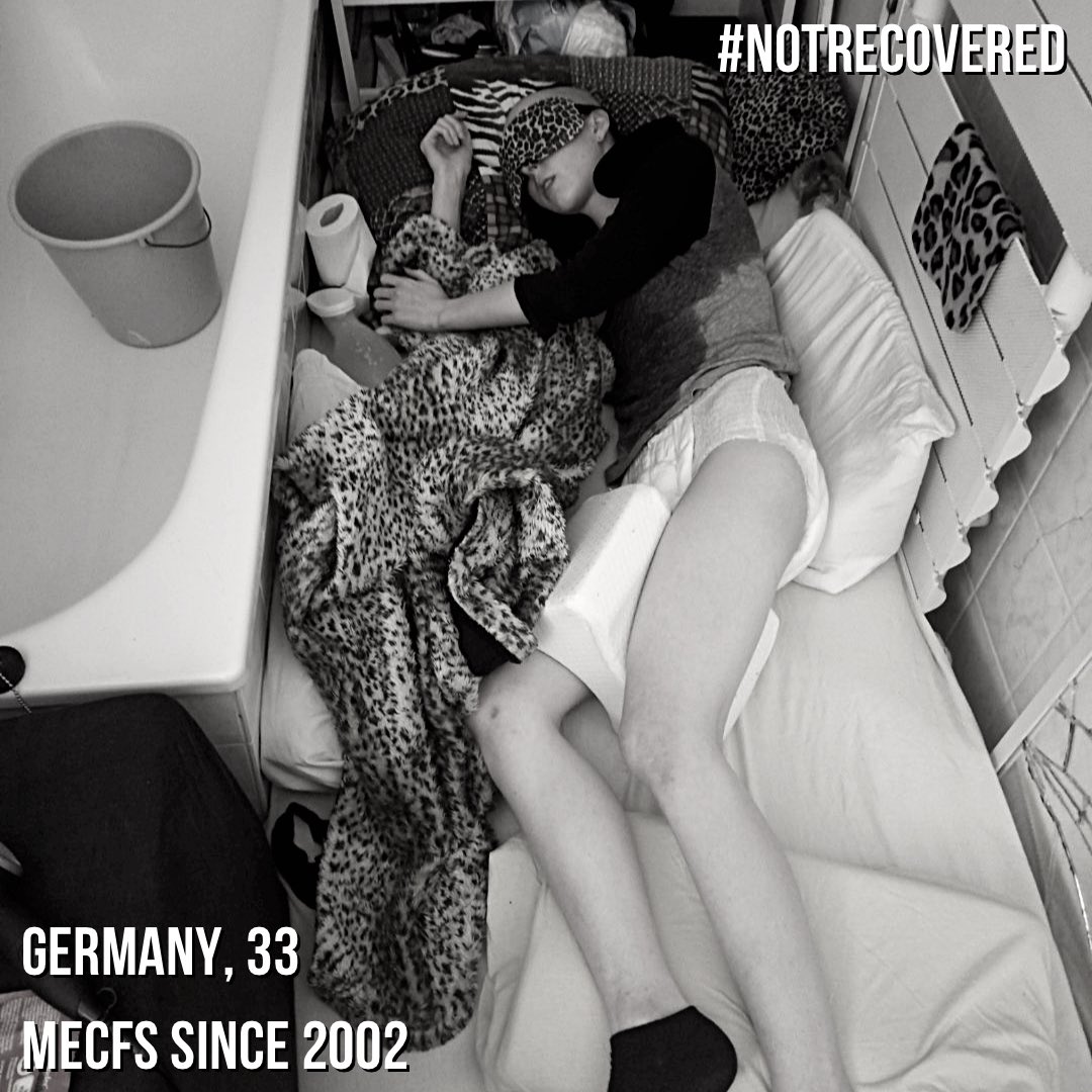 Not_Recovered's tweet photo. „I suffer of #MECFS. Since 4 years i have to live in a bathroom (Bell 0), in darkness, 100% bedridden, starving, thirsty, isolated, mostly paralyzed, feeling pain feeling like terminal cancer. There is no help, no support. …“  
- @BathroomZombie 

1/3 https://t.co/N0WVgxyWBX