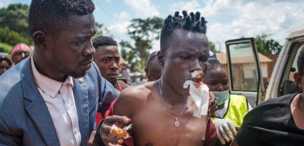 NalwaddaHarima4's tweet photo. #WhatHappeningInUganda
@SecBlinken @Europarl_EN @UKParliament @EUtoAU @EUinUG @BBCWorld @BBCAfrica @UNGeneva @UN_HRC @UNHumanRightsUG @UN @UNWatch @amnesty @RishiSunak @TotalEnergies @IntlCrimCourt 
#StandUpForHumanRights
#StopAbductionsUG
#EndTortureIn🇺🇬
#Sanction 
#StopEACOP https://t.co/xuA8rnLaHx