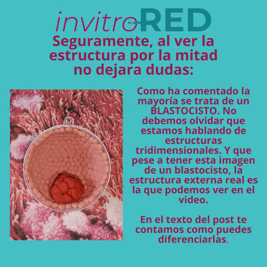 InvitroREDes's tweet photo. Aquí tenéis la respuesta a la pregunta del otro día:
#invitrored #infertilpandy #fertilidad #embrion #blastocisto #morula #invitro #fiv #ivf #icsi #donacion #ovodon #inseminacion #comunidadRA #RAsistida #busquedadeembarazo #dgp #pgt #embarazo #quieromibebe https://t.co/KbOwj3eIye