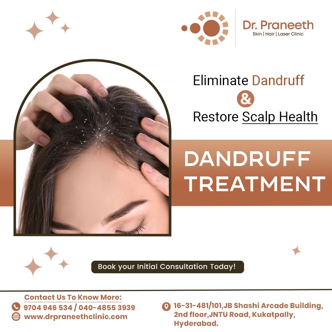 DrPraneethKumar's tweet photo. DANDRUFF TREATMENT
Eliminate your Dandruff and restore Scalp Health.

Visit - https://t.co/9ejlFHxmbt
Call for Appointment - 9704946534/040-48553939

#drpraneeth  #scalping  #scalp #dandrufftreatment #dandrufftreatments #hair   #hairspecialist #restorescalp #kukatpally #Hyderabad https://t.co/L1fqOfylmO