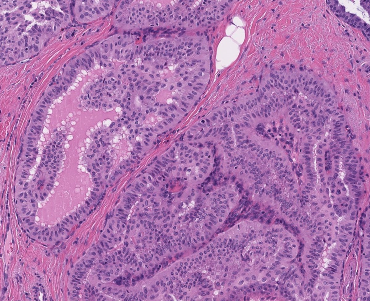 ihartpathology tweet picture