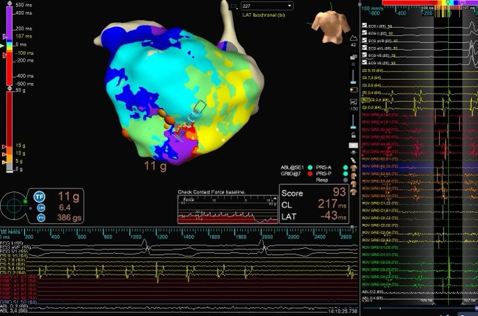 Parin Patel, MD tweet media