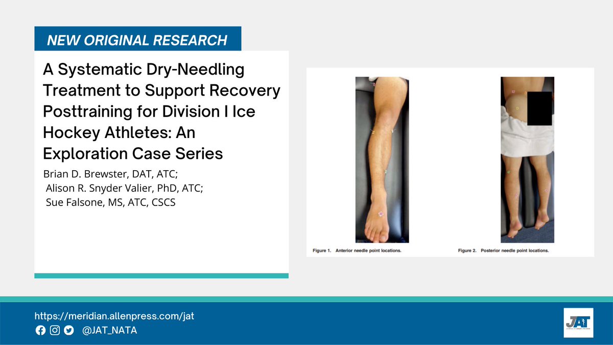 JAT_NATA's tweet photo. In the new issue from Brian D. Brewster, DAT, ATC and colleagues:

A Systematic Dry-Needling Treatment to Support Recovery Posttraining for Division I Ice Hockey Athletes: An Exploration Case Series

Article: https://t.co/dKpLwINOnz https://t.co/yLFFMTfcmn