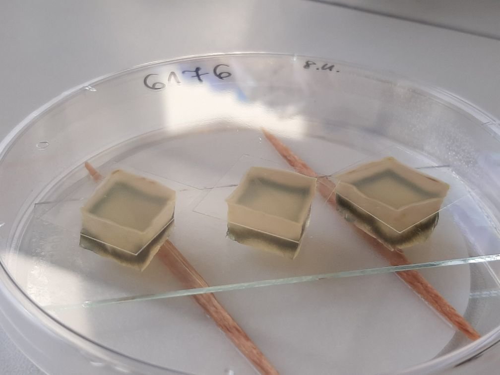 extremefungi's tweet photo. For a good start of the week: the #blackyeast #Aureobasidium growing in agar cubes with #melanisation only in certain regions. Different zones of oxygenation?
Looks tasty 😋
#yeast #extremefungi #fungi https://t.co/IgCRnBSIWY