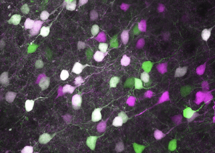 LambeLab's tweet photo. 1/ Patch clampers at #SFN22! Postdoc opening @LambeLab in Toronto 🇨🇦. Neuromodulation and plasticity of prefrontal cortex. Small lab, great colleagues, vibrant city. MONDAY afternoon, come by our #SFN2022 talk &amp; posters (344.03, 360.05, 360.08) to say hi... links below https://t.co/f3ev0MLr0j