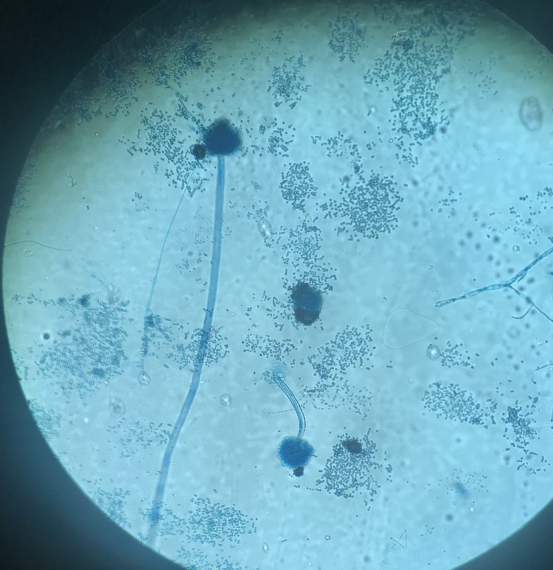 cmthompson15's tweet photo. Microscopic morphology shows septate hyphae, long smooth conidiophores, biseriate phialides that cover the entire vesicle (hard to tell from these pictures though). Thoughts on the ID?? https://t.co/AkCVzqHzSU