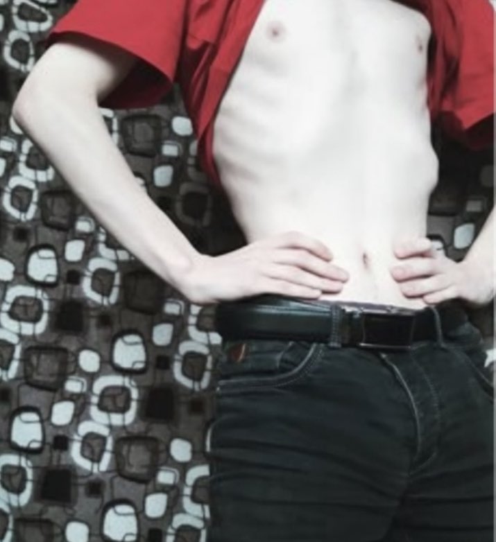 xXsugarwoundsXx's tweet photo. https://t.co/eXbB1JTBat