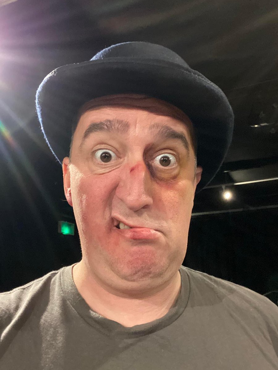 SharpConrad's tweet image. Rough day at work. Photoshoot for my new show #MILKTEETH left me a bit battered. @rum_luck @GreenwichTheatr