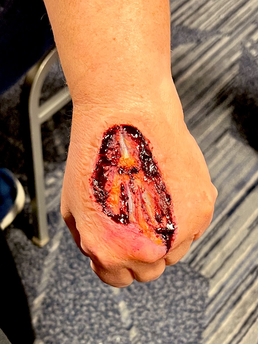 heygoddard's tweet photo. Scenes from today’s 8-hour moulage and prosthetics class. I may have found a new hobby… 😳
#EMSsymposium @virginiaems #moulage #specialFX #EMS #alwayslearning #firefighter https://t.co/tCKgegNkeX