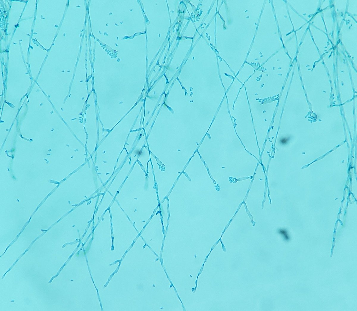 KennyGPhD's tweet photo. Course in Clinical Fungi 🍄🔬

Happy #FungalFriday, day 5 of the practical lab - melanized fungi. Shown below: Rhinocladiella, Phialophora, Curvularia, and Bipolaris. I always thought that the Pleosporales were kinda cute lol 😅

#FDLC #clinmicro #mycology #fungi #MedED https://t.co/8dJJsVXljH