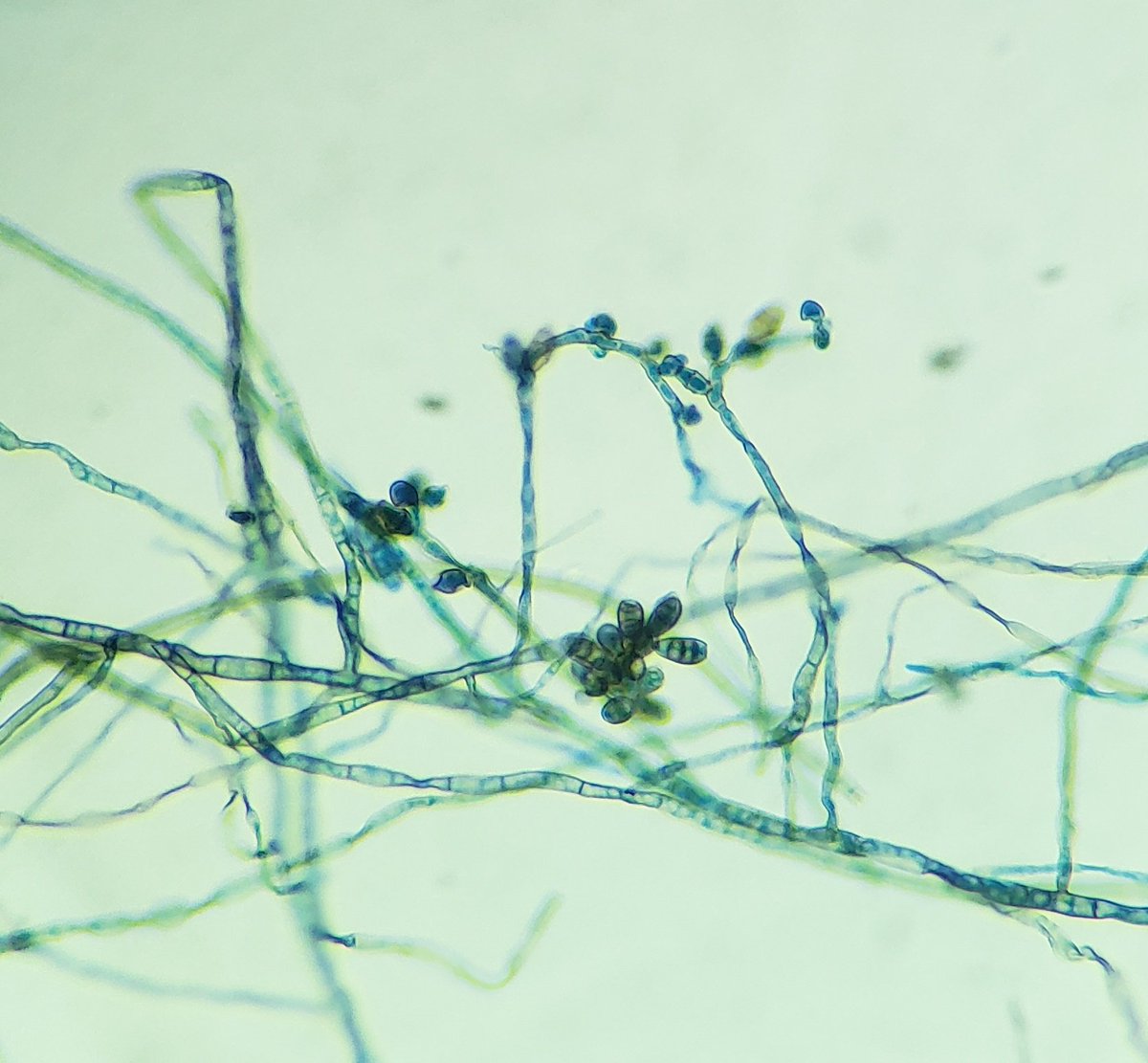 KennyGPhD's tweet photo. Course in Clinical Fungi 🍄🔬

Happy #FungalFriday, day 5 of the practical lab - melanized fungi. Shown below: Rhinocladiella, Phialophora, Curvularia, and Bipolaris. I always thought that the Pleosporales were kinda cute lol 😅

#FDLC #clinmicro #mycology #fungi #MedED https://t.co/8dJJsVXljH