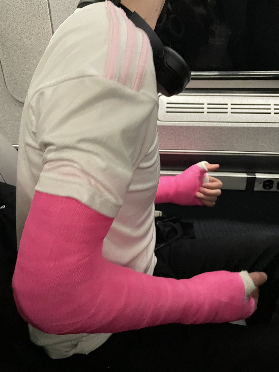 brokenbrosxx's tweet photo. Brokenboi on the train in a pair of bright pink long arm casts! 

#dlats #armcasts https://t.co/rU59qjUDBF