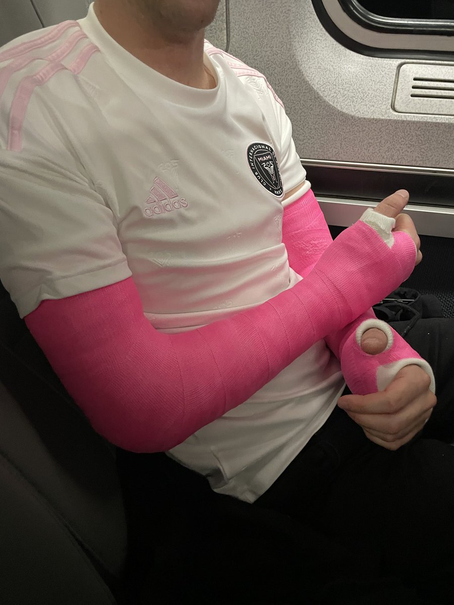 brokenbrosxx's tweet photo. Brokenboi on the train in a pair of bright pink long arm casts! 

#dlats #armcasts https://t.co/rU59qjUDBF