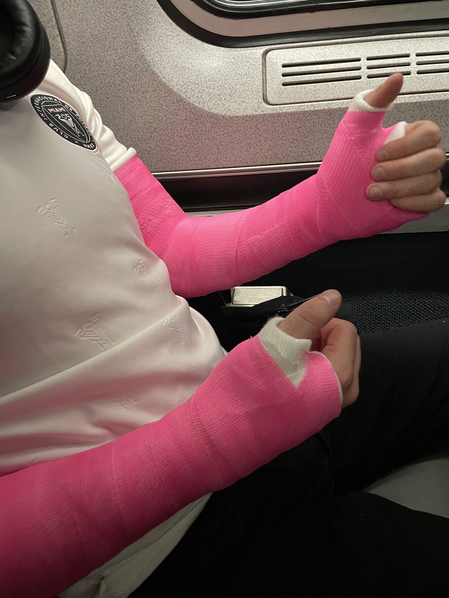 brokenbrosxx's tweet photo. Brokenboi on the train in a pair of bright pink long arm casts! 

#dlats #armcasts https://t.co/rU59qjUDBF
