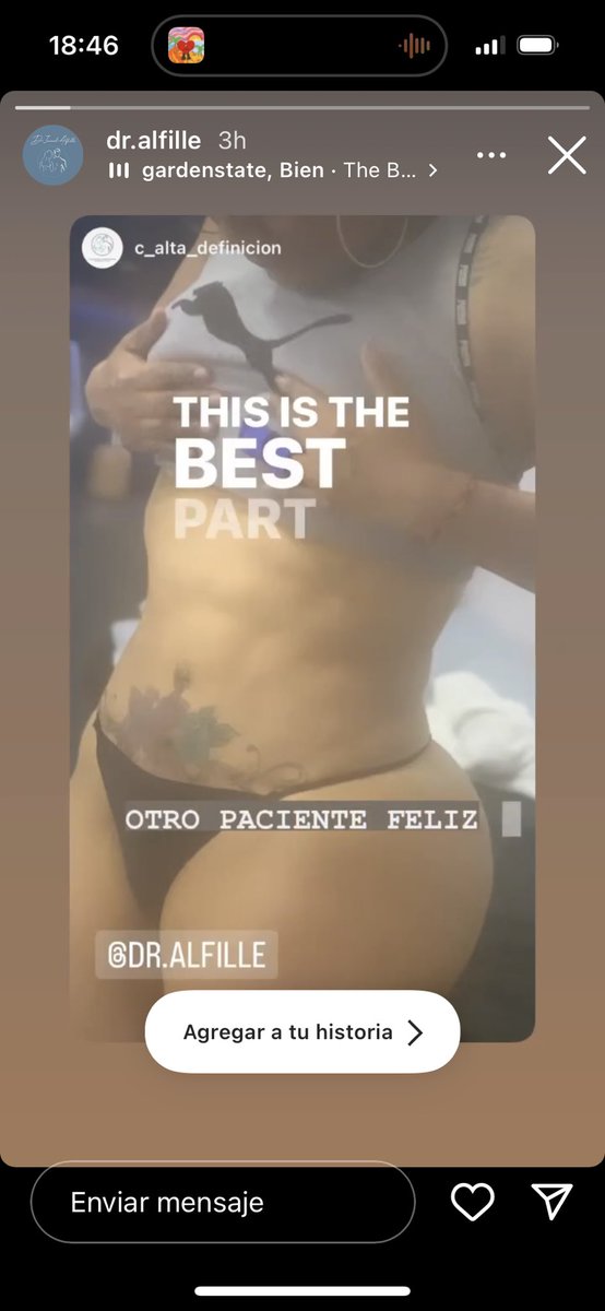 DefinicionC's tweet photo. A solo un mes de su hidrolipo, quien quiere una cintura colombiana ? Whats 5522140769 https://t.co/BVOh945JbI