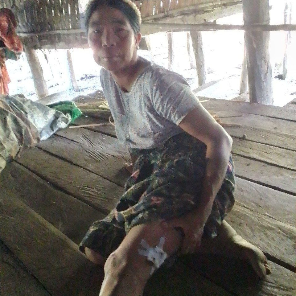 ArakanBaynews's tweet photo. 12 years old boy and a woman were woman were wounded from SAC army artillery shelling in Kyaung Taung Village, Mrauk Oo, Rakhine, Myanmar. Nov 12, 2022 #WarCrimesOfJunta #MMArmy #Rakhine #Arakan https://t.co/jLviZrjr1R