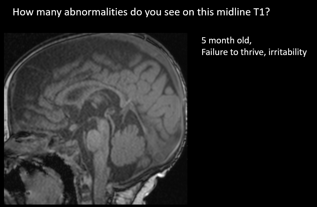 Still not too late to register for CNRC and join us for some amazing peds neuro content -ALL DAY on Saturday Nov 12, 2022!

Talks will be available to view online from November 16 until December 31, 2022.
cnrcourse.ca/?page_id=94

A sneak peak below: