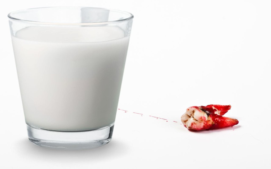 BradfordDentist's tweet image. Do keep a knocked-out tooth moist while on the way to your dentist, but don’t put it in water – use milk instead.

Read the full article: What To Do About A Knocked-Out Tooth
▸ lttr.ai/4j2c

#Bradforddentist #DentalEmergency #KnockedOutTooth