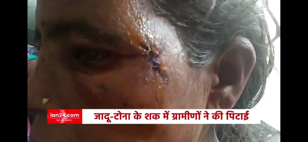 kavyasharma0's tweet photo. #बिसाहिन_को_इंसाफ_दो

बैगा-तांत्रिक दशरथ खैरवार द्वारा भड़काए जाने पर गांव के उप-सरपंच परमेश्वर ध्रुव तथा साथियों के द्वारा मासूम आदिवासी बुजुर्गों पर किया गया जानलेवा हमला। असहाय, गरीब दंपत्ति अब तक न्याय से कोसों दूर है।

https://t.co/crykbTTjod https://t.co/IeHX12MKTM