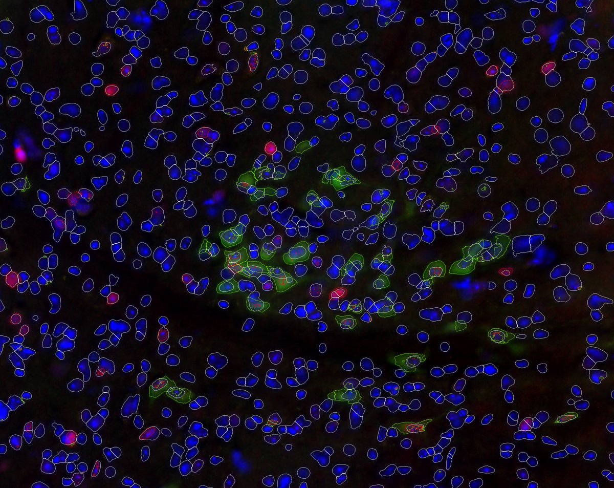 Sarah_Mulloy's tweet photo. Interested in a cool analysis pipeline to quantify RNAscope puncta and insight into alcohol regulation mechanisms? Come check out my recent work at #SFN22 on Sunday at 1pm (board NN10) “Regulation of alcohol reward by cholinergic midbrain nuclei”! https://t.co/564apAwhoi