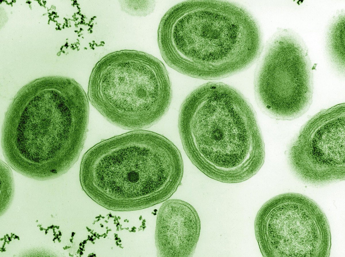tera_levin's tweet photo. #Prochlorococcus may be more of a #mixotroph than it lets on. The #microbe may get as much as one-third of its carbon through consuming the dissolved remains of other dead #microbes.
https://t.co/xxsM1Lvfw6 (2/2) https://t.co/24y534O896