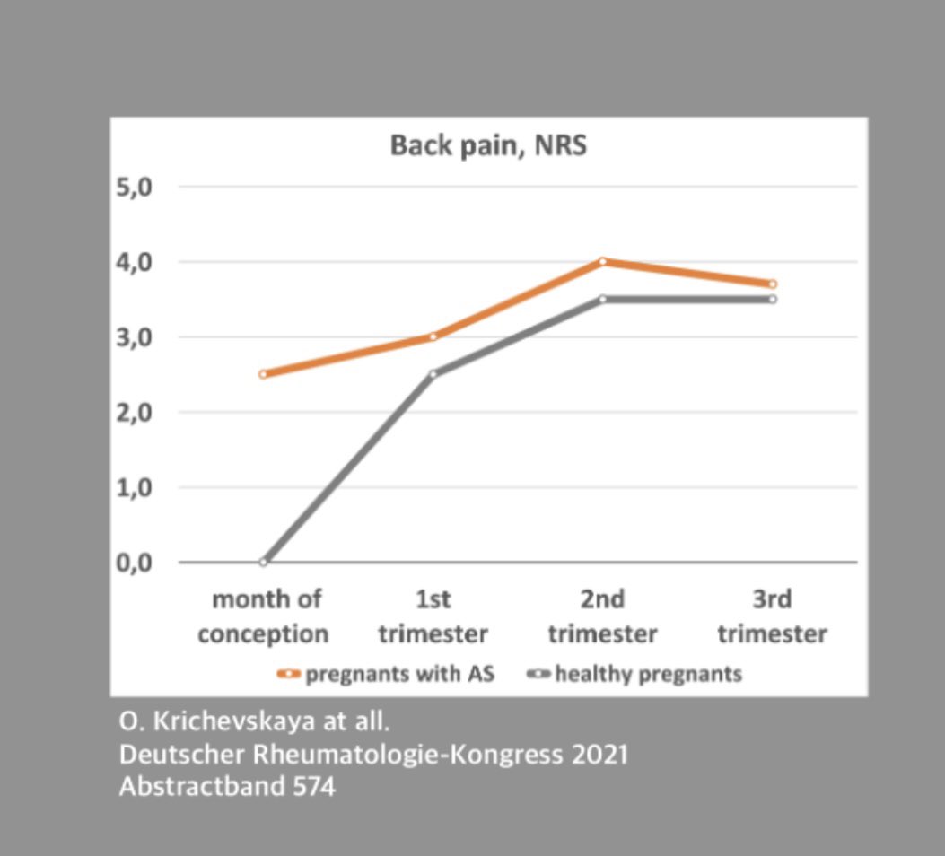 DrPetryna's tweet photo. Pregnancy associated back pain and fatigue during 3rd trimester of pregnancy may affect accuracy of BASDAI score in women with AS. Morning stiffness has the highest classification value #ABS0374 #ACR22 @RheumNow https://t.co/DozZ6bxSU3
