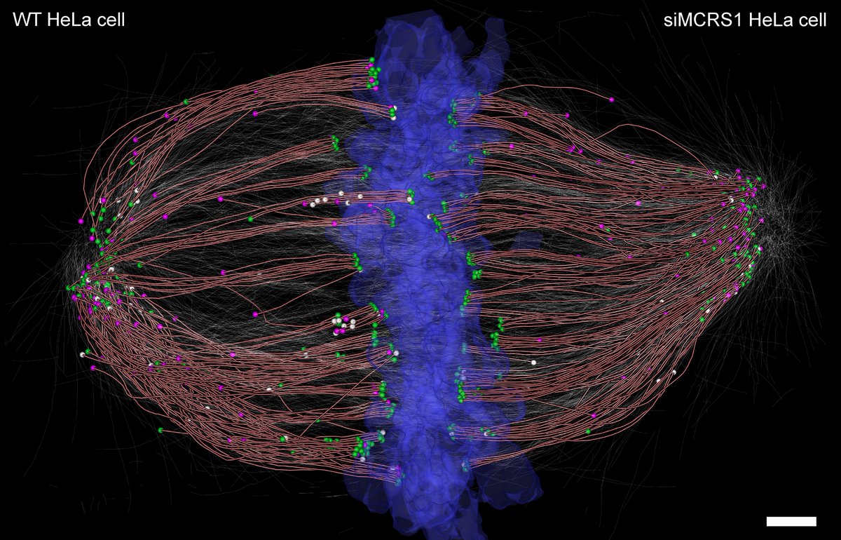 Robert Kiewisz (@rkiewisz) on Twitter photo @AlejandraLagui1 @MBoCjournal <a href="/IsabelleVernos/">Isabelle Vernos</a> <a href="/CRGenomica/">Centre for Genomic Regulation (CRG)</a> Also special thanks to @CfciDresden. Together we were able to find a way to perform these amazing experiments... with a small break for a coffee ☕️ @AlejandraLagui1 @MBoCjournal <a href="/IsabelleVernos/">Isabelle Vernos</a> <a href="/CRGenomica/">Centre for Genomic Regulation (CRG)</a> Also special thanks to @CfciDresden. Together we were able to find a way to perform these amazing experiments... with a small break for a coffee ☕️