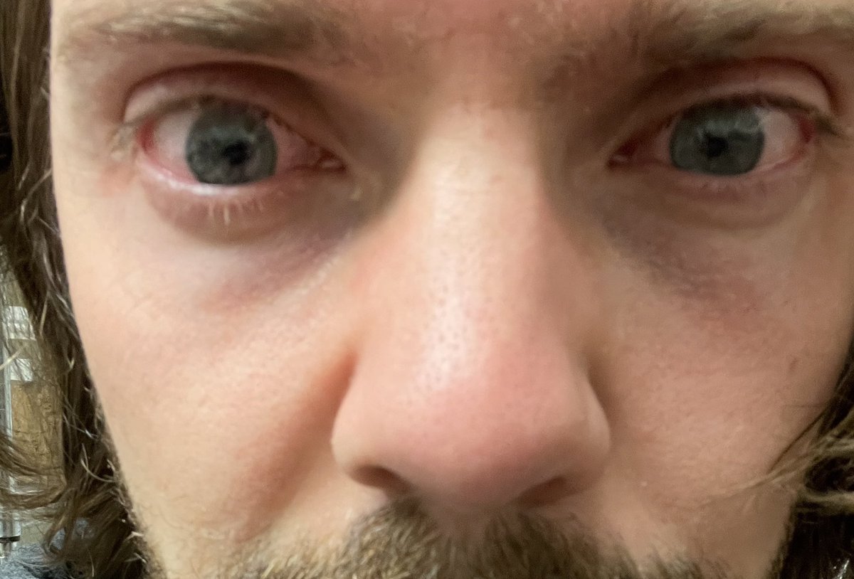Aaron tweet media