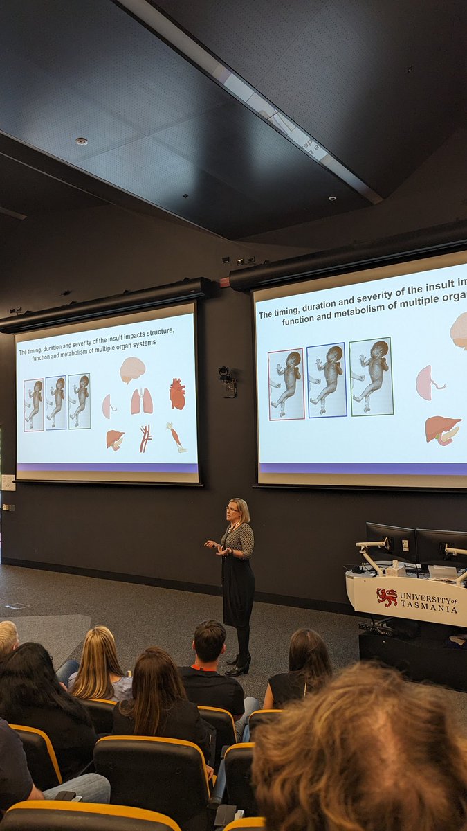 Ashley Meakin (@asmeakin) on Twitter photo Brilliant work being presented by <a href="/ProfessorJanna/">Prof Janna Morrison</a> at <a href="/AuPhysiolSoc/">Australian Physiological Society</a> #AuPS2022. A truly fantastic scientist and mentor. What a way to kick off this year's conference! Brilliant work being presented by <a href="/ProfessorJanna/">Prof Janna Morrison</a> at <a href="/AuPhysiolSoc/">Australian Physiological Society</a> #AuPS2022. A truly fantastic scientist and mentor. What a way to kick off this year's conference!