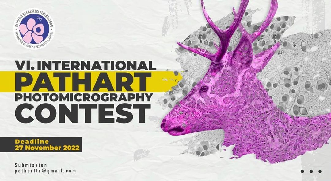 Happy Sunday! and reminder of the day: Have you submitted your artwork to this year’s international #pathart contest?

Send your artwork and join us in this adventure with colleagues from different parts of the globe!
submission rules: turkjpath.org/contest_2022_r…

#repost @turkjpath