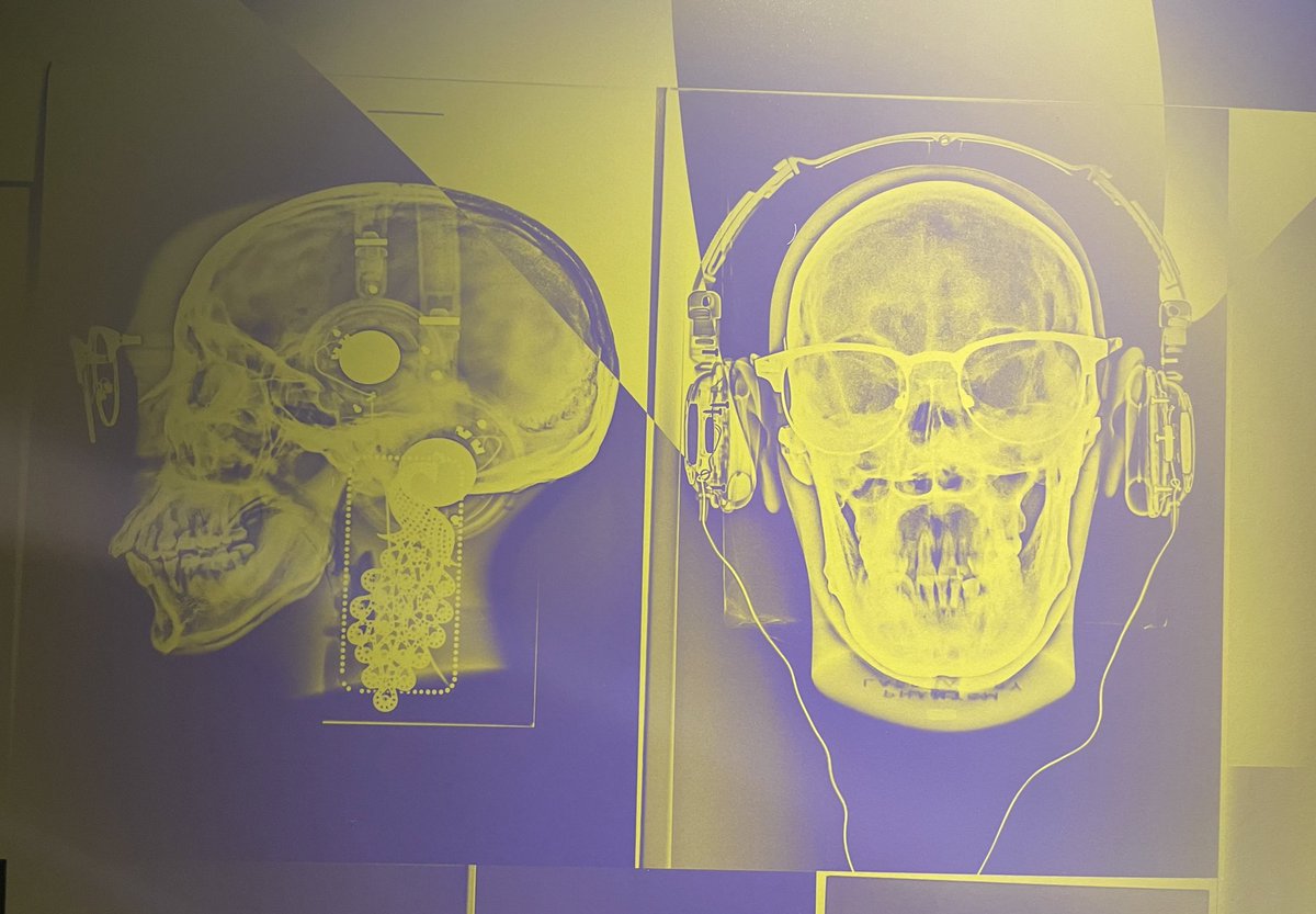 Dr Erica McAlister (@flygirlnhm) on Twitter photo Then the lads that are <a href="/GDunnArt/">Greg Dunn Neuro Art</a> and <a href="/xrayartist/">Hugh Turvey HonFRPS</a> talked art and science
Here is Greg’s son talking to Hugh about his work- Hugh’s work all about X-rays and art (yes they are my little ponies!)
<a href="/RatioBG/">Ratio</a> #science #art #radiology Then the lads that are <a href="/GDunnArt/">Greg Dunn Neuro Art</a> and <a href="/xrayartist/">Hugh Turvey HonFRPS</a> talked art and science
Here is Greg’s son talking to Hugh about his work- Hugh’s work all about X-rays and art (yes they are my little ponies!)
<a href="/RatioBG/">Ratio</a> #science #art #radiology