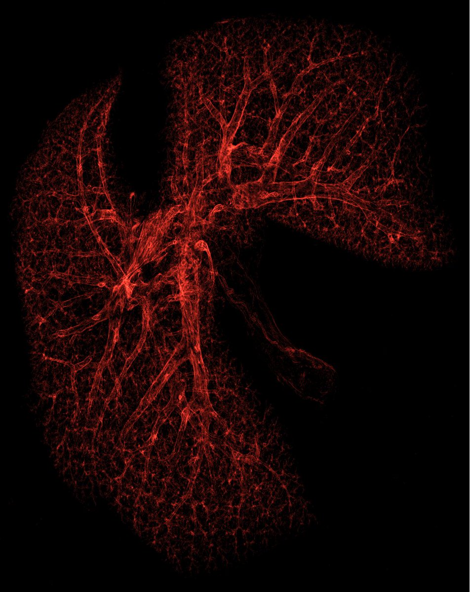 AI-based CODA method maps the architecture and spatial cellular composition of tissues and organs in 3D.

For instance, here is the vasculature in mouse lungs.

Download paper here: nature.com/articles/s4159…
or here: biorxiv.org/content/10.110…