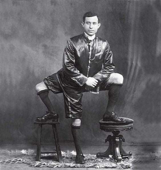 Frank Lentini, an owner of 3 legs, 4 feet, 16 toes, and 2 functioning sets of genitals.
He almost had it all 😀