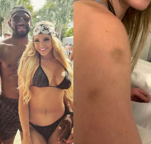 Delsu_Official's tweet photo. New photos show OnlyFans star Courtney Clenney covered in bruises after stabbing Nigerian boyfriend to death https://t.co/SyjSqnuy1H https://t.co/Xt9iAywkAE