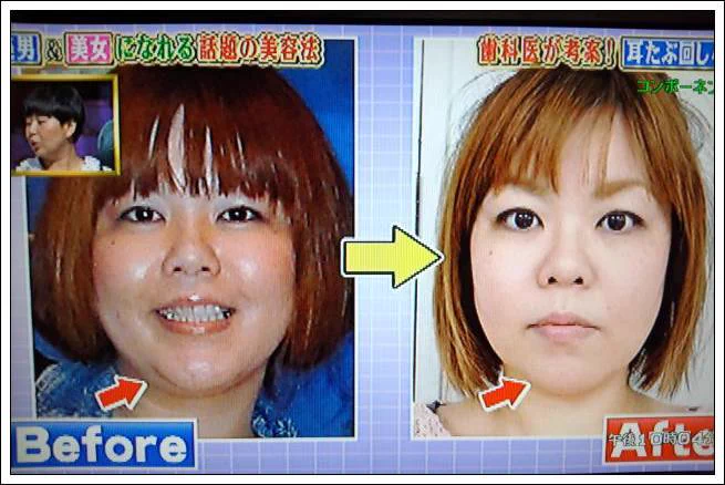 低気圧頭痛やめまいに悩む方必見！小顔効果もある簡単マッサージ。