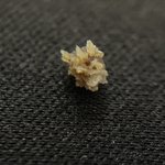 見るだけで痛そう!自然排出された尿管結石がこちら!