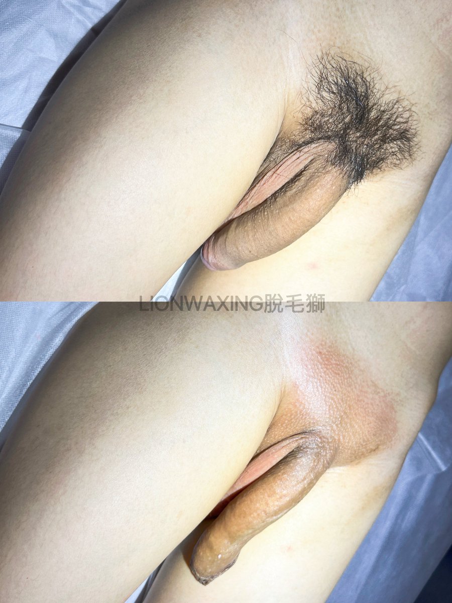 脫毛獅 LION WAXING 🦁 脫毛 ｜抓龍根｜美容｜ 男體拍攝 tweet media