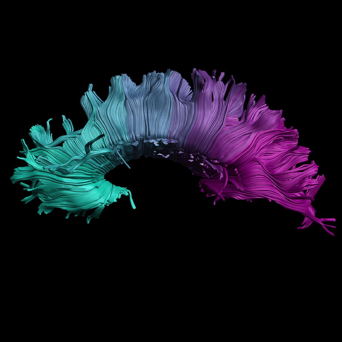 OHBM_BrainArt's tweet image. #WeekendBrainArt 🌈
Building Bridges by Sarah Treit
"Diffusion tractography of the corpus callosum - the largest white matter tract - connects the two hemispheres. This corpus callosum is coloured roughly representing the gradient of myelination during development."