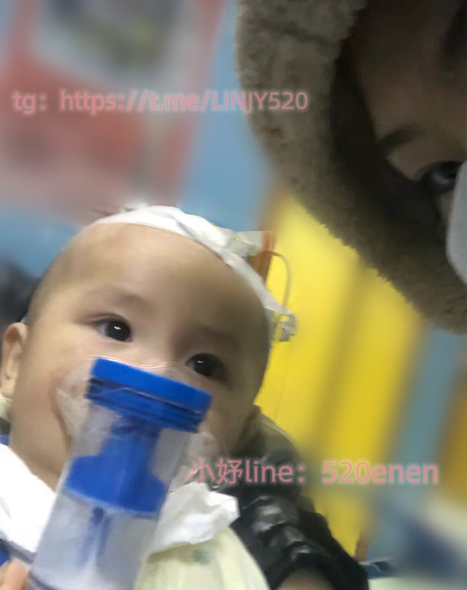 兒子今天一直哭鬧不止 身體還發燙燒到38.3度 我被嚇壞了帶到醫院診出是急性中耳炎 寶寶這麽小就在頭上打針 家裏也很多事情都在花錢 身上也沒有什麽錢了  不知道要怎麽辦了 好心的哥哥可以幫助小妤的話 一定感恩 https://t.co/QtWJbkvHBy