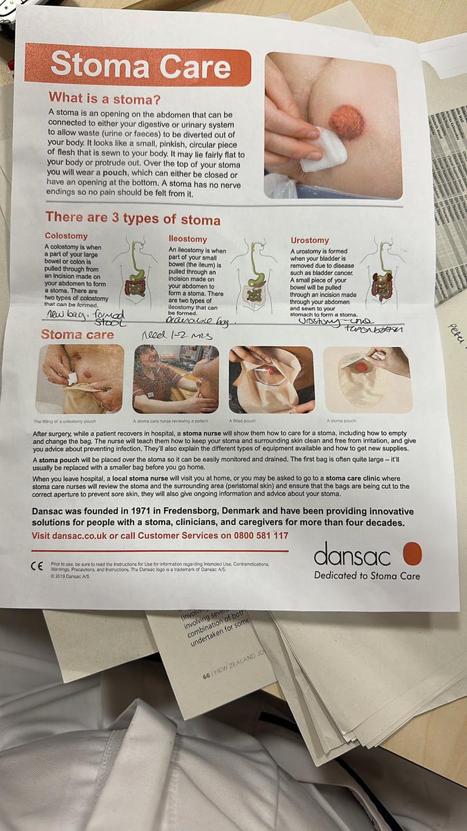 BHRUT_ARCCS therapy team (@bhrut_arccsteam) on Twitter photo Our surgical therapists had a brilliant training session this week on stoma care to improve and understand stoma care, what to do in an emergency stoma burst and rehab stoma patients safely. Thanks Dansac! <a href="/harjitmaras/">Harjit Kaur Maras</a> <a href="/OceanA_bhrut/">Ocean A</a> <a href="/jennipalser/">Jenni Palser</a> Our surgical therapists had a brilliant training session this week on stoma care to improve and understand stoma care, what to do in an emergency stoma burst and rehab stoma patients safely. Thanks Dansac! <a href="/harjitmaras/">Harjit Kaur Maras</a> <a href="/OceanA_bhrut/">Ocean A</a> <a href="/jennipalser/">Jenni Palser</a>