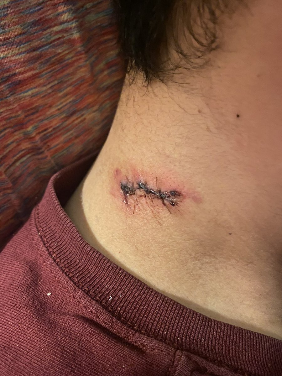 gawk's tweet image. A hair in any direction and I would’ve been dead. I’m a happy to be alive.